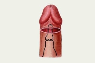 kako povečati penis